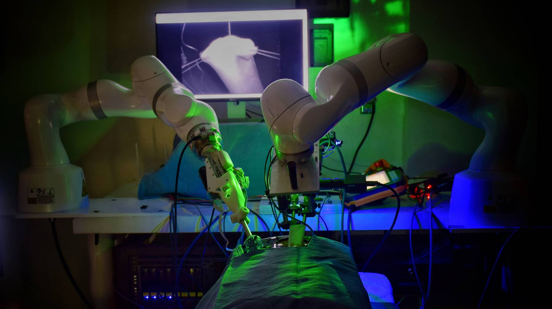 Přečtete si více ze článku Robot poprvé provedl laparoskopickou operaci bez pomoci člověka
