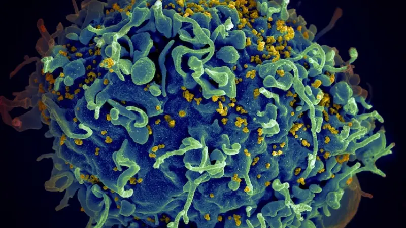 Přečtete si více ze článku Lékaři vyléčili třetího pacienta s HIV. Využili k tomu transplantaci kmenových buněk